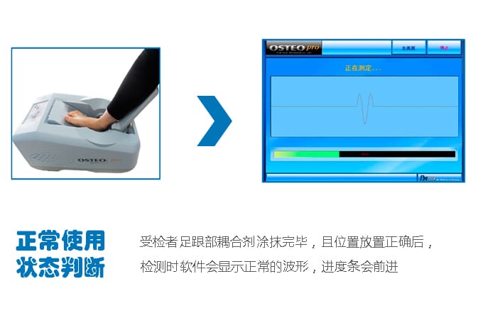 raybet雷竞技网页入口正常判断_骨密度测定