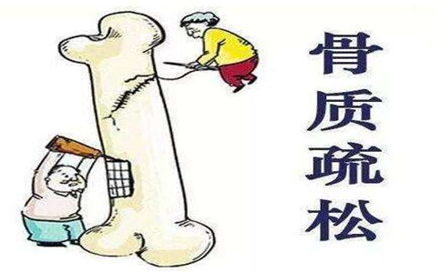 骨密度分析仪厂家：骨密度的几种健康管理方式