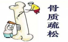 保护骨骼 正确认知骨密度