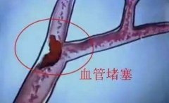 雷竞技时时乐攻略帮您检查脑血管“堵塞”