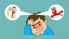 经颅多普勒厂家讲解：脑血管健康风险有哪些发病征象