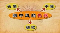 脑中风的前兆早知道 经颅多普勒帮助检查脑血管健康风险