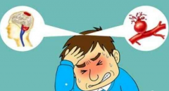心脑血管健康风险症状，经颅多普勒尽早检查