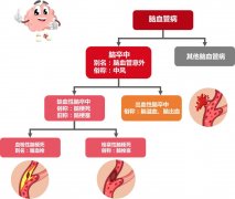 主要的脑血管健康风险——脑卒中是如何分类的