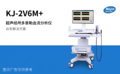 经颅多普勒是查什么的？