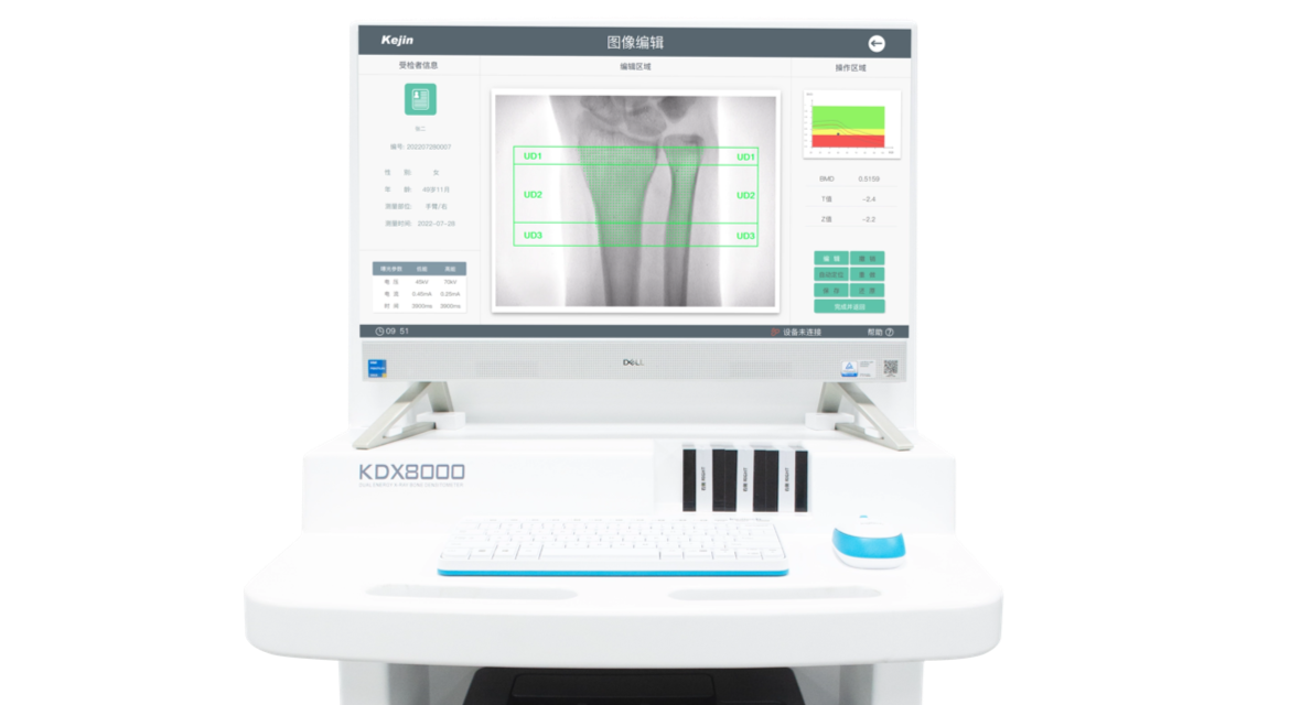 双能X射线raybet雷竞技网页入口KDX8000系列应用示意图